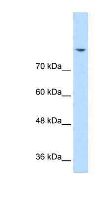 Western Blot: PSD93 Antibody [NBP1-59715] - Jurkat cell lysate, concentration 0.2-1 ug/ml.