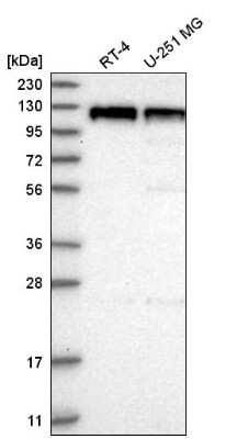 Western Blot: PSD93 Antibody [NBP2-58558] - Analysis in human cell line RT-4 and human cell line U-251 MG.