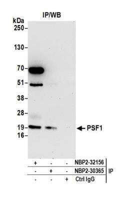 Immunoprecipitation: PSF1 Antibody [NBP2-30365] - Detection of human PSF1 by western blot of immunoprecipitates. Samples: Whole cell lysate (1.0 mg per IP reaction; 20% of IP loaded) from 293T cells prepared using NETN lysis buffer. Antibodies: Affinity purified rabbit anti-PSF1 antibody NBP2-30365 used for IP at 6 ug per reaction. PSF1 was also immunoprecipitated by rabbit anti-PSF1 antibody NBP2-32156. For blotting immunoprecipitated PSF1, A304-168A was used at 1 ug/ml. Detection: Chemiluminescence with an exposure time of 30 seconds.