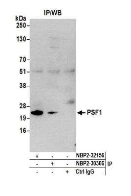 Immunoprecipitation: PSF1 Antibody [NBP2-30366] - Detection of human PSF1 by western blot of immunoprecipitates. Samples: Whole cell lysate (1.0 mg per IP reaction; 20% of IP loaded) from 293T cells prepared using NETN lysis buffer. Antibodies: Affinity purified rabbit anti-PSF1 antibody NBP2-30366 used for IP at 3 ug per reaction. PSF1 was also immunoprecipitated by rabbit anti-PSF1 antibody NBP2-32156. For blotting immunoprecipitated PSF1, NBP2-30366 was used at 1 ug/ml. Detection: Chemiluminescence with an exposure time of 3 minutes.