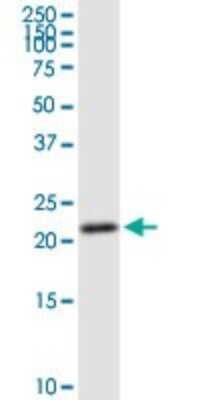 Western Blot: PSF1 Antibody [H00009837-D02P] - Analysis of GINS1 expression in Jurkat.