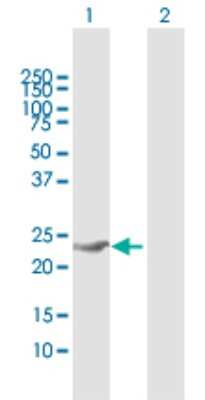 Western Blot: PSF1 Antibody [H00009837-D02P] - Analysis of GINS1 expression in transfected 293T cell line by GINS1 polyclonal antibody.Lane 1: GINS1 transfected lysate(21.67 KDa).Lane 2: Non-transfected lysate.