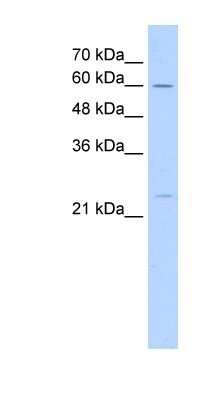 Western Blot: PSF1 Antibody [NBP1-56488] - Titration: 5.0ug/ml Positive Control: HepG2 cell lysate.