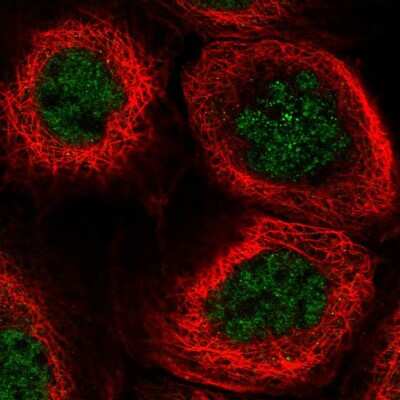 Immunocytochemistry/ Immunofluorescence PSF3 Antibody