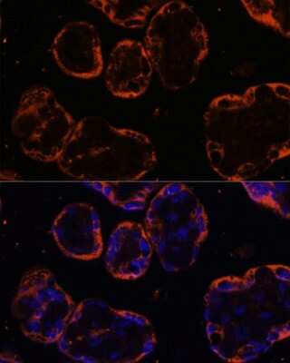 Immunocytochemistry/Immunofluorescence: PSG1 Antibody [NBP2-93944] - Analysis of human placenta cells using PSG1 at dilution of 1:100. Blue: DAPI for nuclear staining.