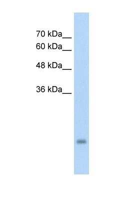 Western Blot: PSG3 Antibody [NBP1-55491] - HepG2 cell lysate, Antibody Titration: 5.0ug/ml