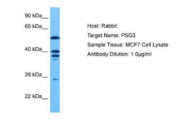 Western Blot: PSG3 Antibody [NBP2-82317] - Host: Rabbit. Target Name: PSG3. Sample Tissue: Human MCF7 Whole Cell. Antibody Dilution: 1.0ug/ml