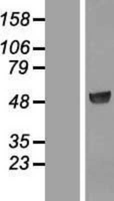 Western Blot: PSG3 Overexpression Lysate (Adult Normal) [NBL1-14866] Left-Empty vector transfected control cell lysate (HEK293 cell lysate); Right -Over-expression Lysate for PSG3.