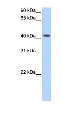 Western Blot: PSG5 Antibody [NBP1-57973] - Human Placenta lysate, concentration 2.5 ug/ml.