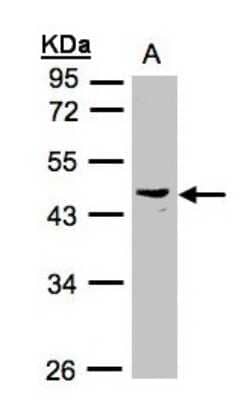 Western Blot: PSG6 Antibody [NBP1-32800] - Sample(30 ug whole cell lysate)A:Raji  10% SDS PAGE, antibody diluted at 1:1000.
