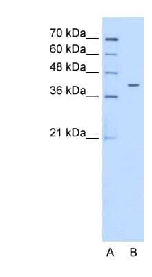 Western Blot: PSG6 Antibody [NBP1-56485] - HepG2 cell lysate, concentration 0.2-1 ug/ml.