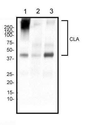 Western Blot: PSGL-1/CD162 Antibody (HECA-452) - Azide and BSA Free [NBP2-80921] - Analysis of human tonsil (1), human spleen (2), and human lymph node (3) tissue using CD162 antibody at a concentration of 2 ug/ml. Image from the standard format of this antibody.