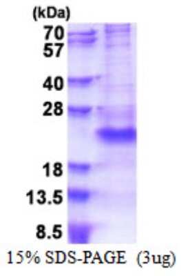 SDS-Page: Recombinant Human PSGL-1/CD162 Protein [NBP2-51546] - 15% SDS Page (3 ug)