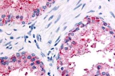 Immunohistochemistry-Paraffin: PSGR Antibody [NLS2027] -  Human prostate, epithelium after heat-induced antigen retrieval.