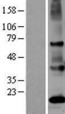 Western Blot PSGR Overexpression Lysate