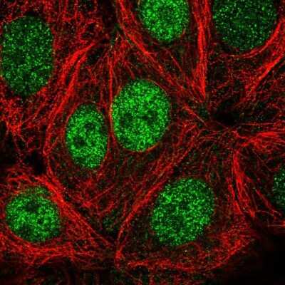 Immunocytochemistry/Immunofluorescence: PSKH1 Antibody [NBP2-49105] - Immunofluorescent staining of human cell line MCF7 shows localization to nucleoplasm.