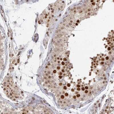 Immunohistochemistry-Paraffin: PSKH1 Antibody [NBP2-49105] - Staining of human testis shows strong nuclear positivity in cells in seminiferus ducts. Leydig cells displayed strong nuclear and cytoplasmic positivity.