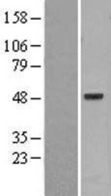 Western Blot PSKH1 Overexpression Lysate