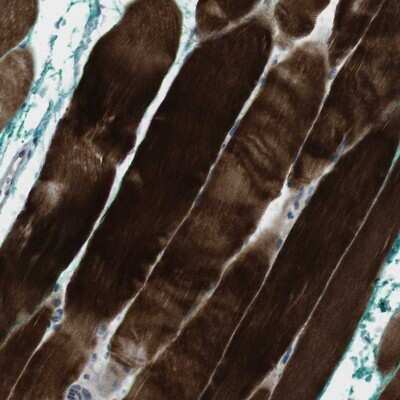 Immunohistochemistry-Paraffin: PSKH2 Antibody [NBP1-86459] - Staining of human skeletal muscle shows strong cytoplasmic positivity in myocytes.