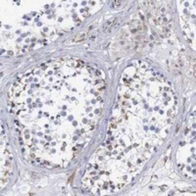 Immunohistochemistry-Paraffin: PSKH2 Antibody [NBP3-17421] - Staining of human testis shows cytoplasmic positivity in seminiferous ducts.