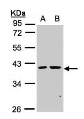 Western Blot: PSKH2 Antibody [NBP1-31467] - Sample(30 ug whole cell lysate) A:MOLT4 B:Raji 10% SDS PAGE, antibody diluted at 1:1000.