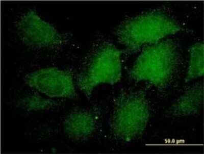 Immunocytochemistry/Immunofluorescence: PSMA1 Antibody (1D9-1C7) [H00005682-M01] - Analysis of monoclonal antibody to PSMA1 on HeLa cell. Antibody concentration 60 ug/ml.