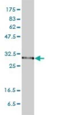 Western Blot: PSMA1 Antibody (1D9-1C7) [H00005682-M01] - PSMA1 monoclonal antibody (M01), clone 1D9-1C7 Analysis of PSMA1 expression in HeLa.