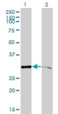 Western Blot: PSMA1 Antibody (1D9-1C7) [H00005682-M01] - Analysis of PSMA1 expression in transfected 293T cell line by PSMA1 monoclonal antibody (M01), clone 1D9-1C7.Lane 1: PSMA1 transfected lysate(30.2 KDa).Lane 2: Non-transfected lysate.