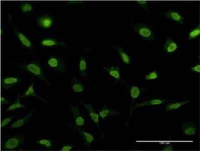 Immunocytochemistry/Immunofluorescence: PSMA1 Antibody (3F12-2C9) [H00005682-M02] - Analysis of monoclonal antibody to PSMA1 on HeLa cell . Antibody concentration 10 ug/ml.