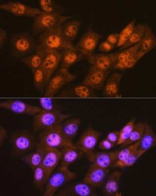 Immunocytochemistry/Immunofluorescence: PSMA1 Antibody (5X3A6) [NBP3-16190] - Immunofluorescence analysis of NIH-3T3 cells using PSMA1 Rabbit mAb (NBP3-16190) at dilution of 1:100 (40x lens). Blue: DAPI for nuclear staining.