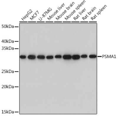 Western Blot: PSMA1 Antibody (5X3A6) [NBP3-16190] - Western blot analysis of extracts of various cell lines, using PSMA1 Rabbit mAb (NBP3-16190) at 1:1000 dilution. Secondary antibody: HRP Goat Anti-Rabbit IgG (H+L) at 1:10000 dilution. Lysates/proteins: 25ug per lane. Blocking buffer: 3% nonfat dry milk in TBST. Detection: ECL Basic Kit. Exposure time: 3s.