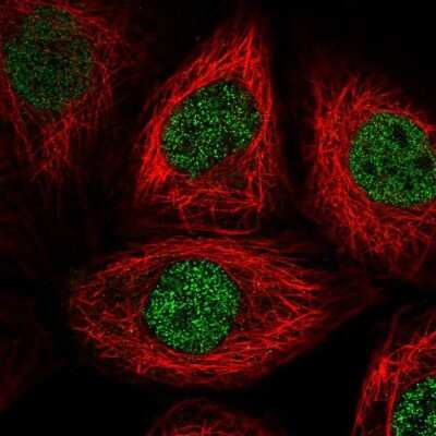 <b>Independent Antibodies Validation. </b>Immunocytochemistry/Immunofluorescence: PSMA1 Antibody [NBP2-37908] - Immunofluorescent staining of human cell line A-431 shows localization to nucleoplasm.