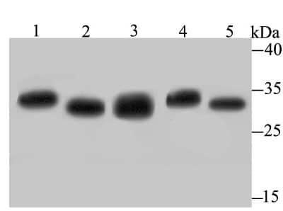 Western Blot: PSMA1 Antibody (JB89-30) [NBP2-75628] - Analysis of Proteasome 20S C2 on different lysates using anti-Proteasome 20S C2 antibody at 1/500 dilution.Positive control:Lane 1: PC-3M    Lane 2: K562   Lane 3: Rat testisLane 4: Mouse testis    Lane 5: Mouse colon
