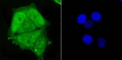 Immunocytochemistry/Immunofluorescence: PSMA1 Antibody (JU66-24) [NBP2-75633] - Staining PSMA1 in MCF-7 cells (green). The nuclear counter stain is DAPI (blue). Cells were fixed in paraformaldehyde, permeabilised with 0.25% Triton X100/PBS.
