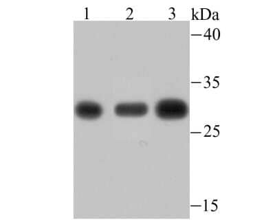 Western Blot: PSMA1 Antibody (JU66-24) [NBP2-75633] - Analysis of PSMA1 on different lysates using anti-PSMA1 antibody at 1/500 dilution.Positive control:Lane 1: PC-12   Lane 2: Mouse spleen tissueLane 3: Rat spleen tissue