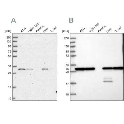 Western Blot: PSMA1 Antibody [NBP2-37908] - Analysis using Anti-PSMA1 antibody NBP2-37908 (A) shows similar pattern to independent antibody NBP1-81768 (B).