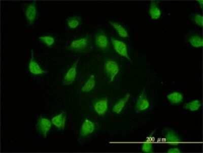 Immunocytochemistry/Immunofluorescence: PSMA4 Antibody (2A10-E4) [H00005685-M01] - Analysis of monoclonal antibody to PSMA4 on HeLa cell. Antibody concentration 10 ug/ml.