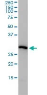 Western Blot: PSMA4 Antibody (2A10-E4) [H00005685-M01] - PSMA4 monoclonal antibody (M01), clone 2A10-E4 Analysis of PSMA4 expression in Hela.