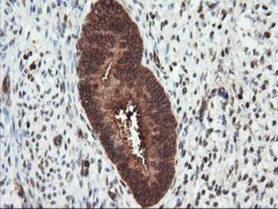 Immunohistochemistry-Paraffin: PSMA4 Antibody (4B8) [NBP2-01608] - Staining of paraffin-embedded Human endometrium tissue using anti-PSMA4 mouse monoclonal antibody.