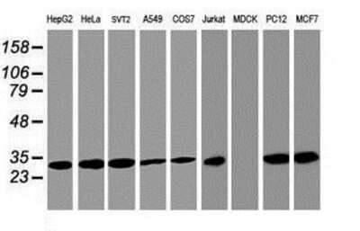 Western Blot: PSMA4 Antibody (4B8) [NBP2-01608] Analysis of extracts (35ug) from 9 different cell lines by using anti-PSMA4 monoclonal antibody.