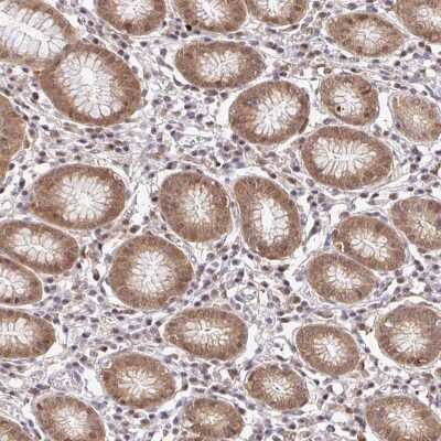 Immunohistochemistry-Paraffin: PSMA4 Antibody [NBP2-38754] - Staining of human stomach, lower shows moderate cytoplasmic and nuclear positivity in glandular cells.