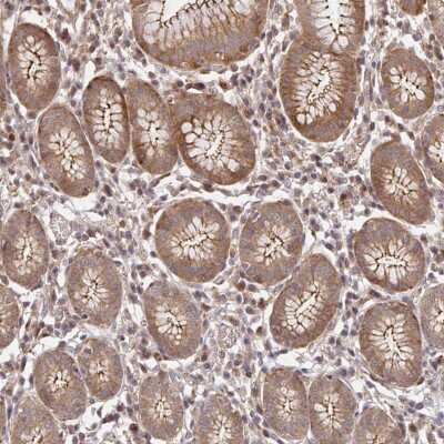 Immunohistochemistry-Paraffin: PSMA4 Antibody [NBP2-38894] - Staining of human stomach shows moderate cytoplasmic positivity in glandular cells.