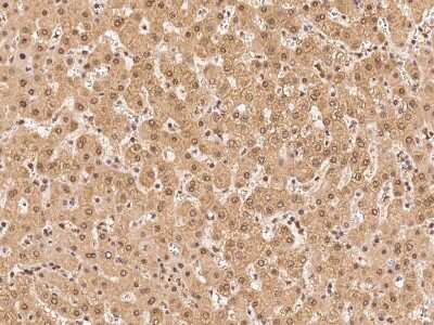 Immunohistochemistry-Paraffin: PSMA4 Antibody [NBP2-99610] - Immunochemical staining of human PSMA4 in human liver with rabbit polyclonal antibody at 1:500 dilution, formalin-fixed paraffin embedded sections.