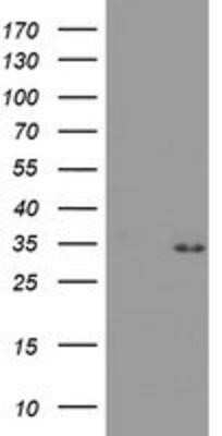 Western Blot: PSMA4 Antibody (OTI4B8) - Azide and BSA Free [NBP2-73690] - HEK293T cells were transfected with the pCMV6-ENTRY control (Left lane) or pCMV6-ENTRY PSMA4 (Right lane) cDNA for 48 hrs and lysed. Equivalent amounts of cell lysates (5 ug per lane) were separated by SDS-PAGE and immunoblotted with anti-PSMA4.