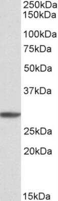 Western Blot: PSMA4 Antibody [NBP1-52074] - Staining of K562 cell lysate (35 ug protein in RIPA buffer). Primary incubation was 1 hour. Detected by chemiluminescence.  