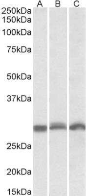 Western Blot: PSMA4 Antibody [NBP1-52074] - Staining of NIH3T3 (A), Mouse Spleen (B), Rat Spleen (C)) lysates (35 ug protein in RIPA buffer). Primary incubation was 1 hour. Detected by chemiluminescence.  