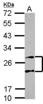 Western Blot: PSMA4 Antibody [NBP2-19982] - Sample (30 ug of whole cell lysate) A: HeLa 12% SDS PAGE gel, diluted at 1:2000.