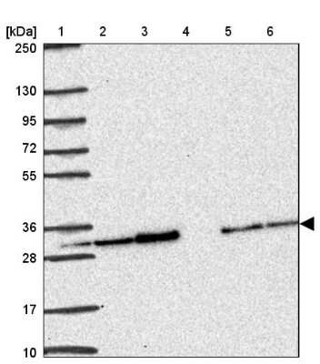 Western Blot: PSMA4 Antibody [NBP2-38754] - Lane 1: Marker  [kDa] 250, 130, 95, 72, 55, 36, 28, 17, 10.  Lane 2: Human cell line RT-4.  Lane 3: Human cell line U-251MG.  Lane 4: Human Plasma.  Lane 5: Human liver tissue.  Lane 6: Human tonsil tissue