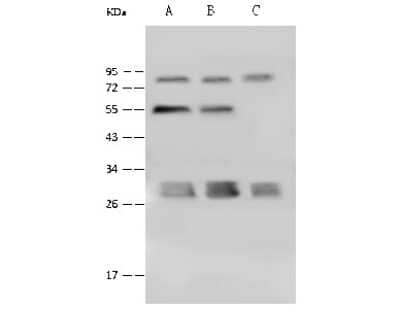 Western Blot: PSMA4 Antibody [NBP2-99610] - Anti-PSMA4 rabbit polyclonal antibody at 1:500 dilution. Lane A: HeLa Whole Cell Lysate Lane B: Jurkat Whole Cell Lysate Lane C: K562 Whole Cell Lysate Lysates/proteins at 30 ug per lane. Secondary Goat Anti-Rabbit IgG (H+L)/HRP at 1/10000 dilution. Developed using the ECL technique. Performed under reducing conditions. Predicted band size: 29 kDa. Observed band size: 29 kDa