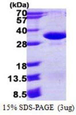 SDS-Page: PSMA4 Protein [NBP1-78849]